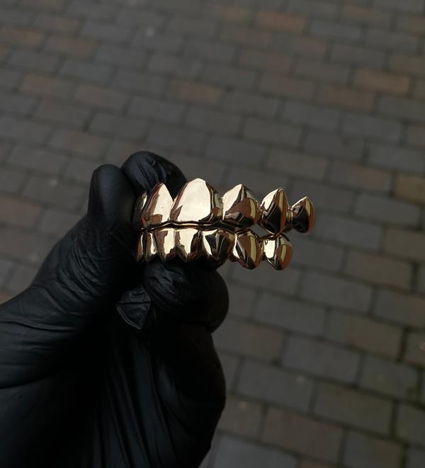 Ouro Gold Teeth Birmingham