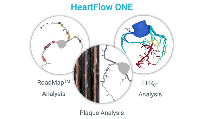 Labor Relations HeartFlow Inc